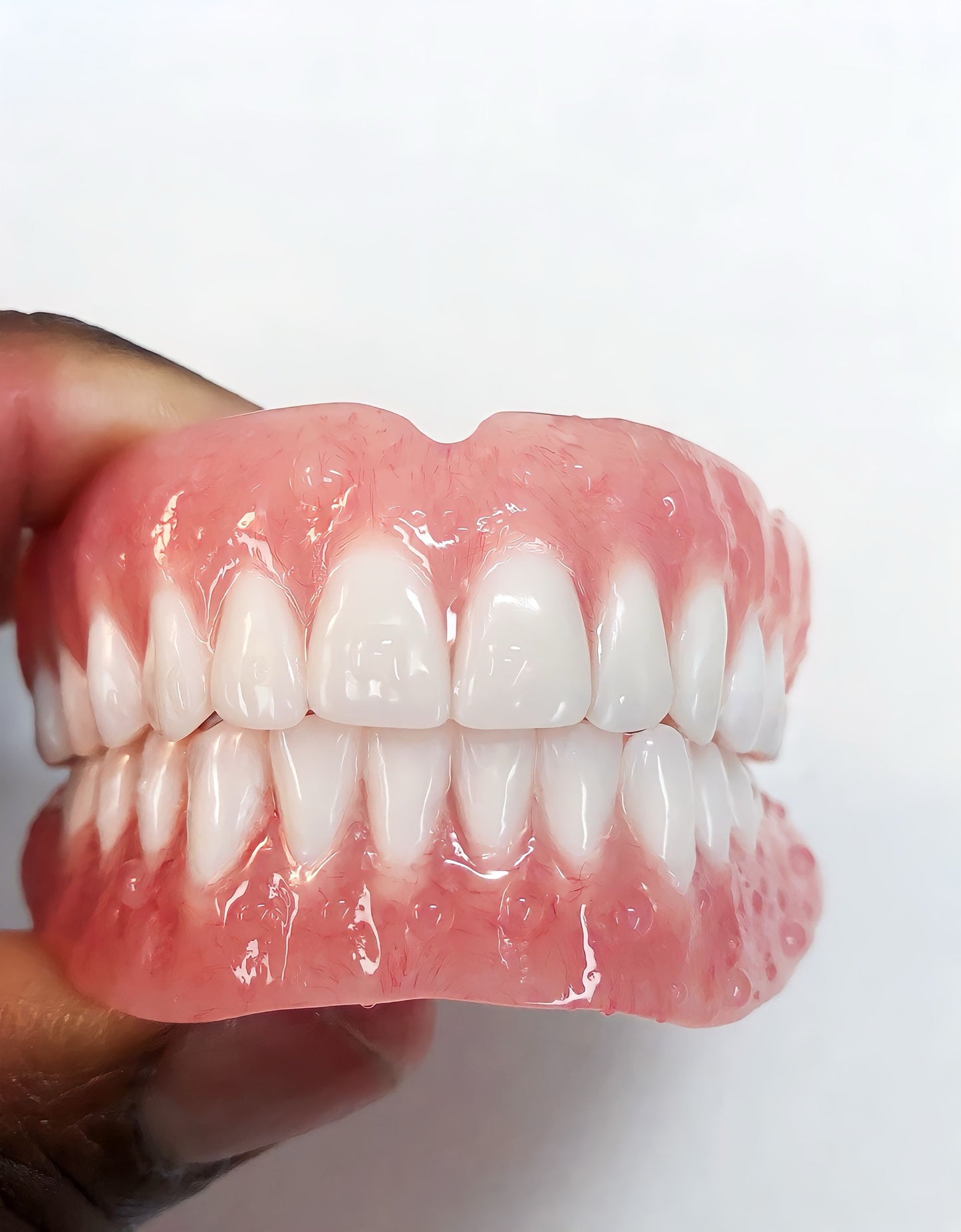 Custom Denture Kit for $1,300: Tailored to Your Perfect Fit (Upper or Lower)