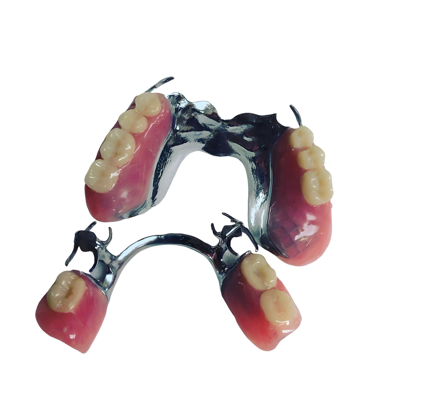 Basic Metal Partial Denture Kit for $550: Strong, Reliable, and Custom-Fit (Upper or Lower)