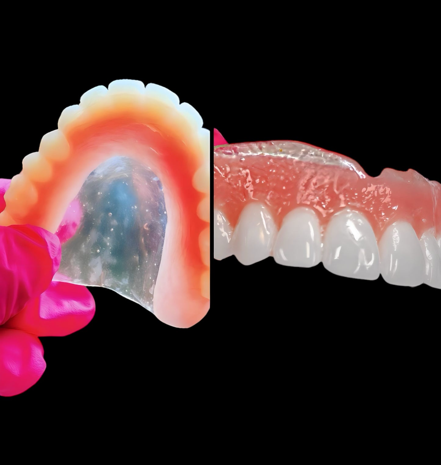 Premium Clear Palate Dentures (Upper and Lower) for $3,000: High-End Custom Solution