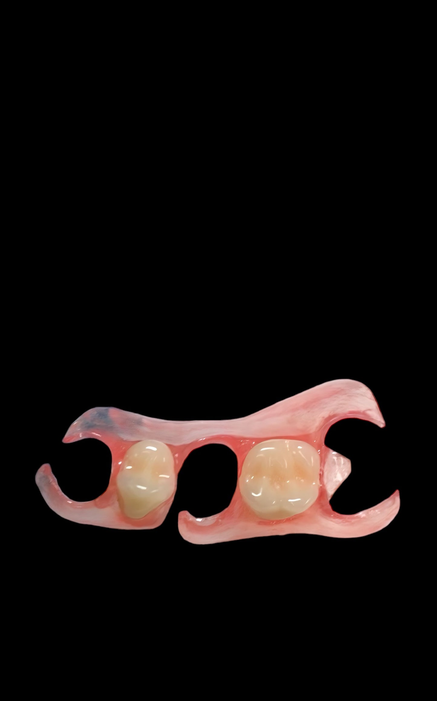 Premium Upper & Lower Flexible Partial Dentures: Realistic 3D Teeth for a Natural Smile