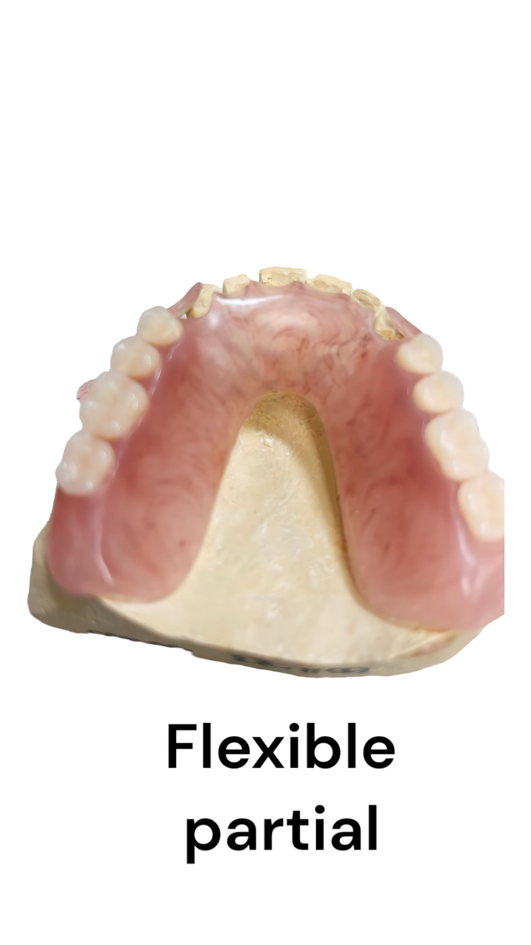 Premium Upper & Lower Flexible Partial Dentures: Realistic 3D Teeth for a Natural Smile